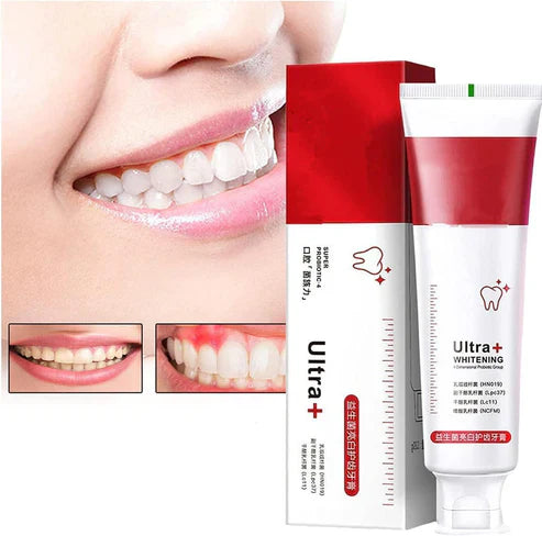 Sp4 Ultra White Teeth Toothpaste