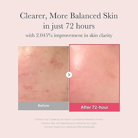 Medicube TXA+Niacinamide 15% Glow Facial Seurm for After Spot Care | All-in-One Daily Korean Skincare