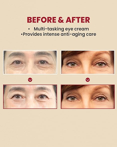 K-SECRET SEOUL 1988 Eye Cream : Retinal Liposome 4% + Fermented Bean
