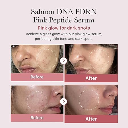 Medicube Salmon DNA PDRN Pink Peptide Serum, Pink glow serum, Peptide, Niacinamide
