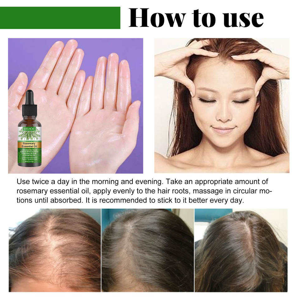Care Essential Oil Anti-loss Hair Growth Hair Care Nourish Scalp Hair Roots