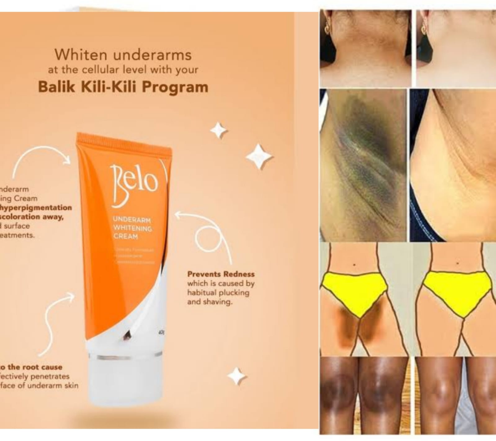 Belo Underarm & Private Parts Whitening Cream