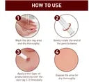 12 Hours Wart Remover Pen Skin Tag Mole Remover Eliminate Foot Corn Warts (Buy 1 Get 1 Free)