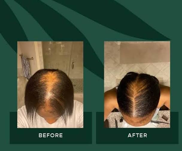Jamaican Black Castor Oil – Fast Hair Growth & Thick, Healthy Hair.
