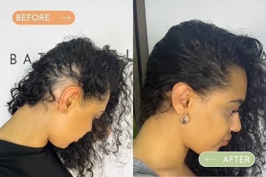 Hair Growth Batana Oil Mask – Natural Formula for Stronger, Thicker & Healthier Hair