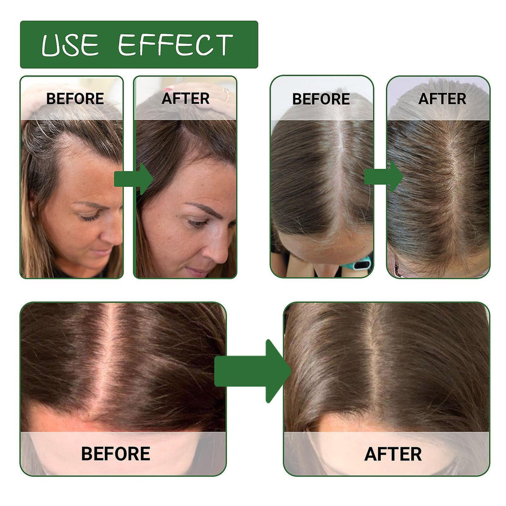 Hair Oil 100% Original Raw Batana Oil
