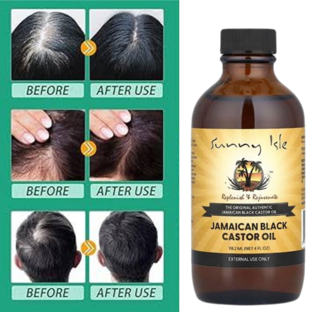 Jamaican Black Castor Oil – Fast Hair Growth & Thick, Healthy Hair.