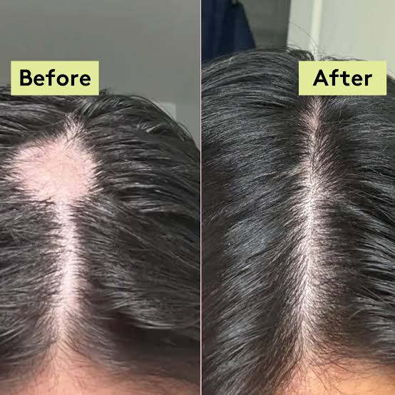 Jamaican Black Castor Oil – Fast Hair Growth & Thick, Healthy Hair.