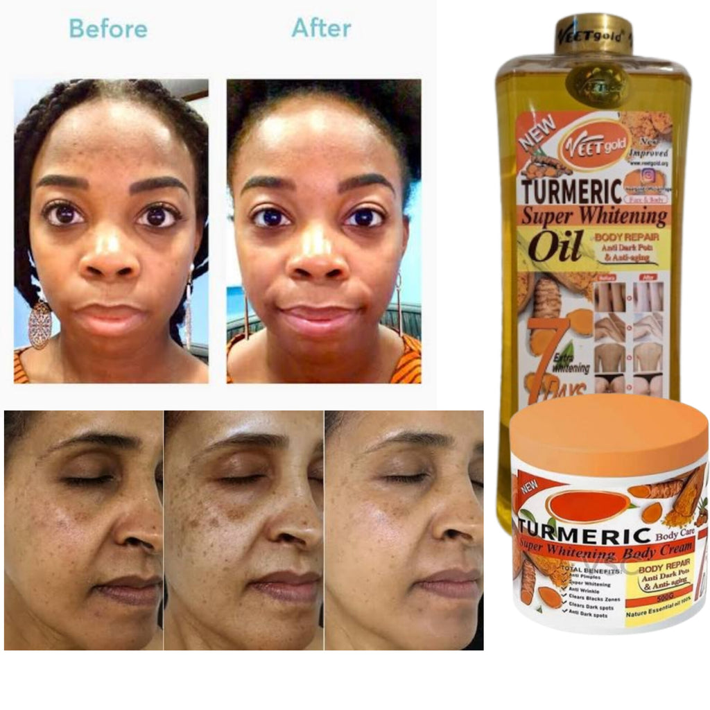 Turmeric Oil (1000ml) with FREE Turmeric Cream (500g) Authentic Imported Product