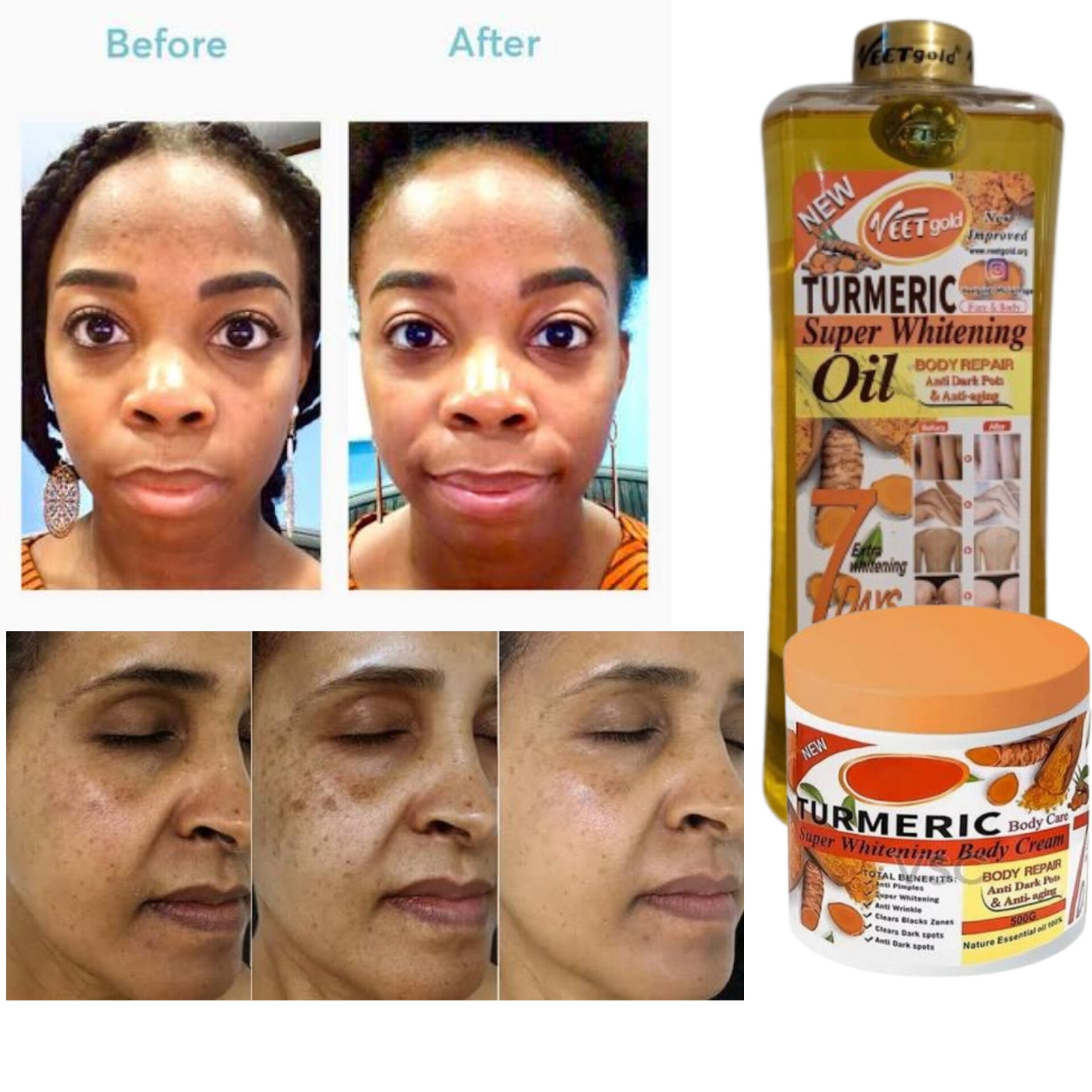 Turmeric Oil (1000ml) with FREE Turmeric Cream (500g) Authentic Imported Product
