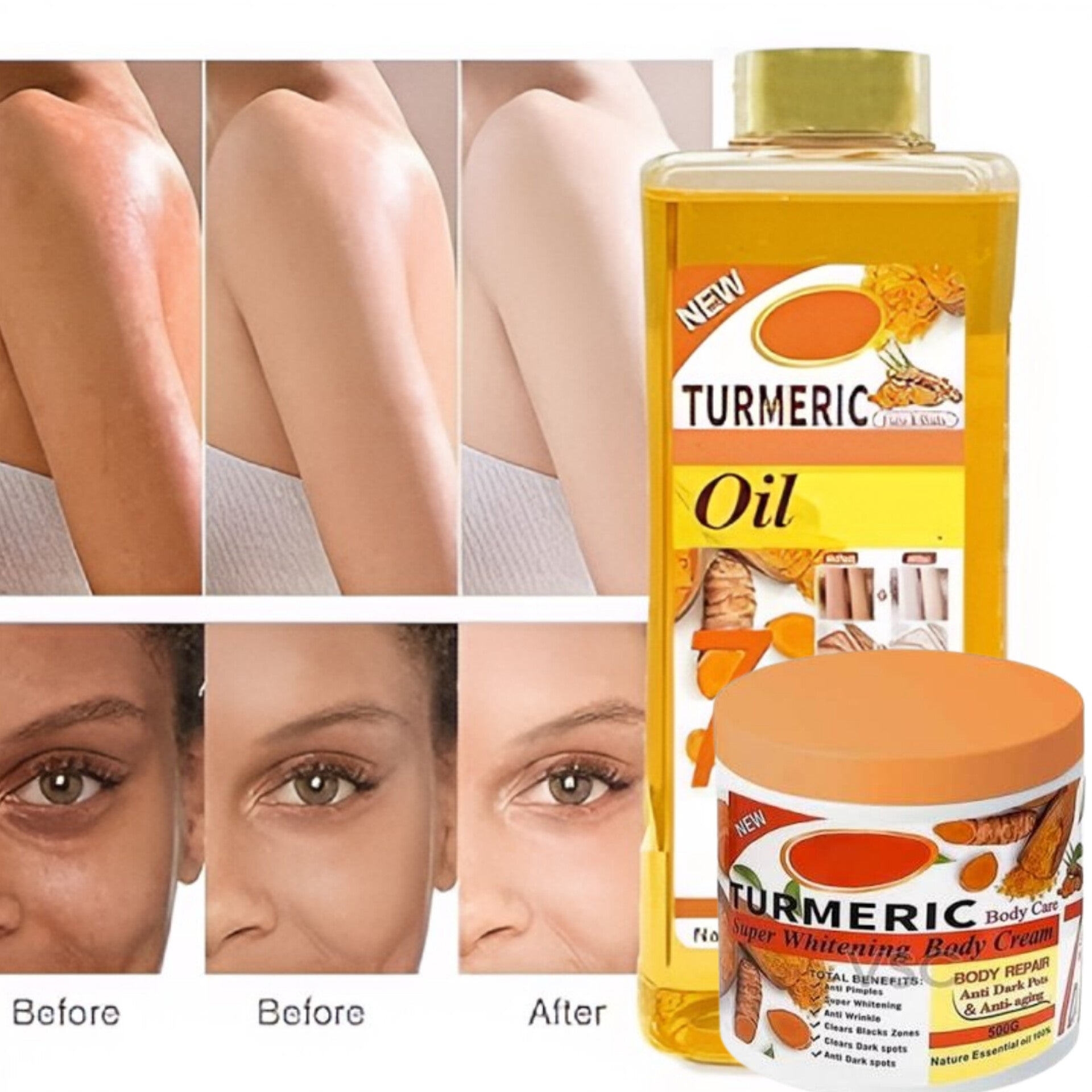 Turmeric Oil (1000ml) with FREE Turmeric Cream (500g) Authentic Imported Product